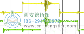 正常脉搏